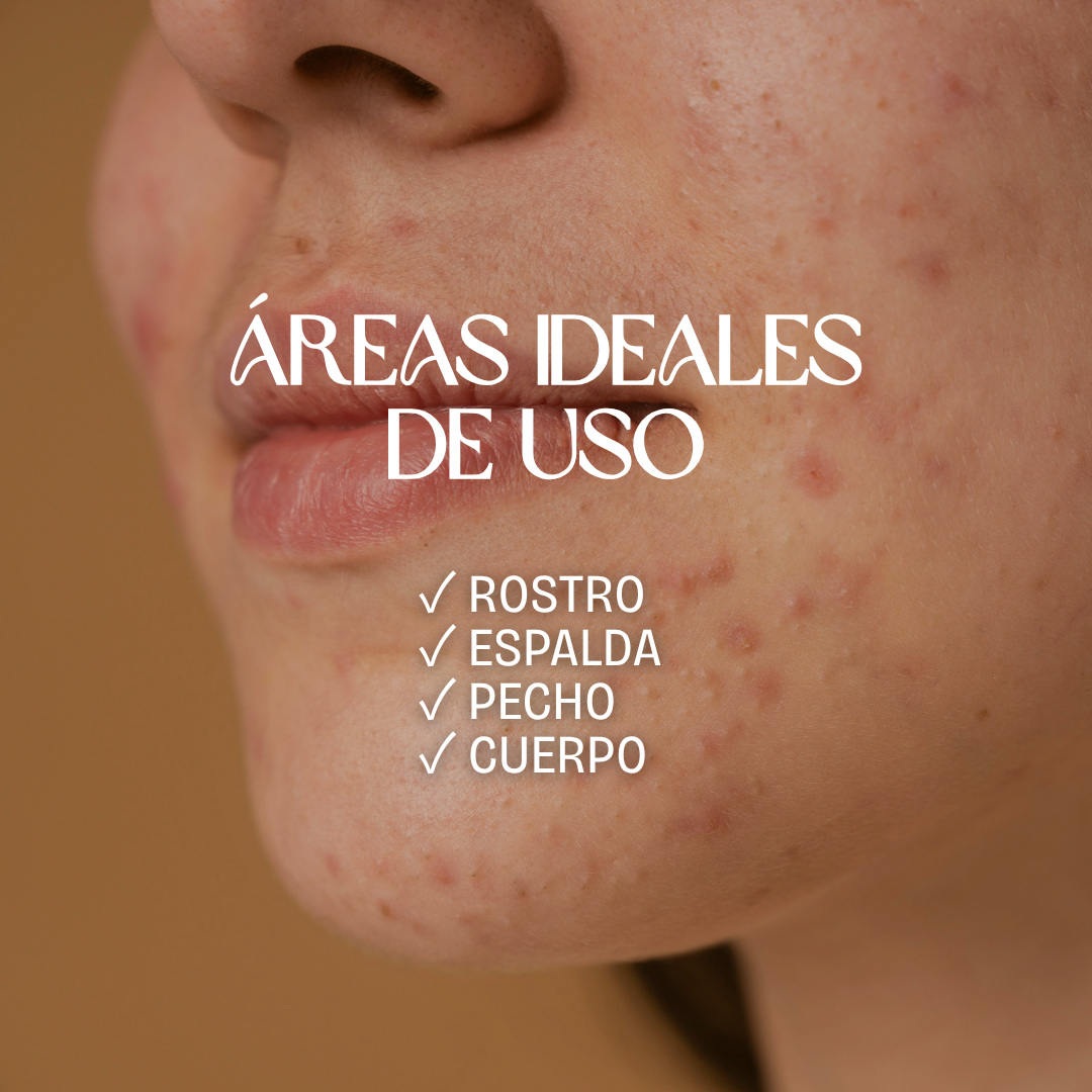 Jabón de Arcilla Rosada y Carbón | DETOX